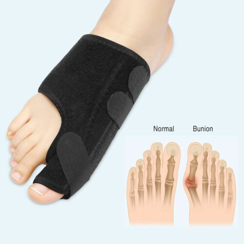 Big Toe Toe Bunion Splint Straightener Corrector Hallux Valgus Relief Foot Pain - Foto 1 di 10