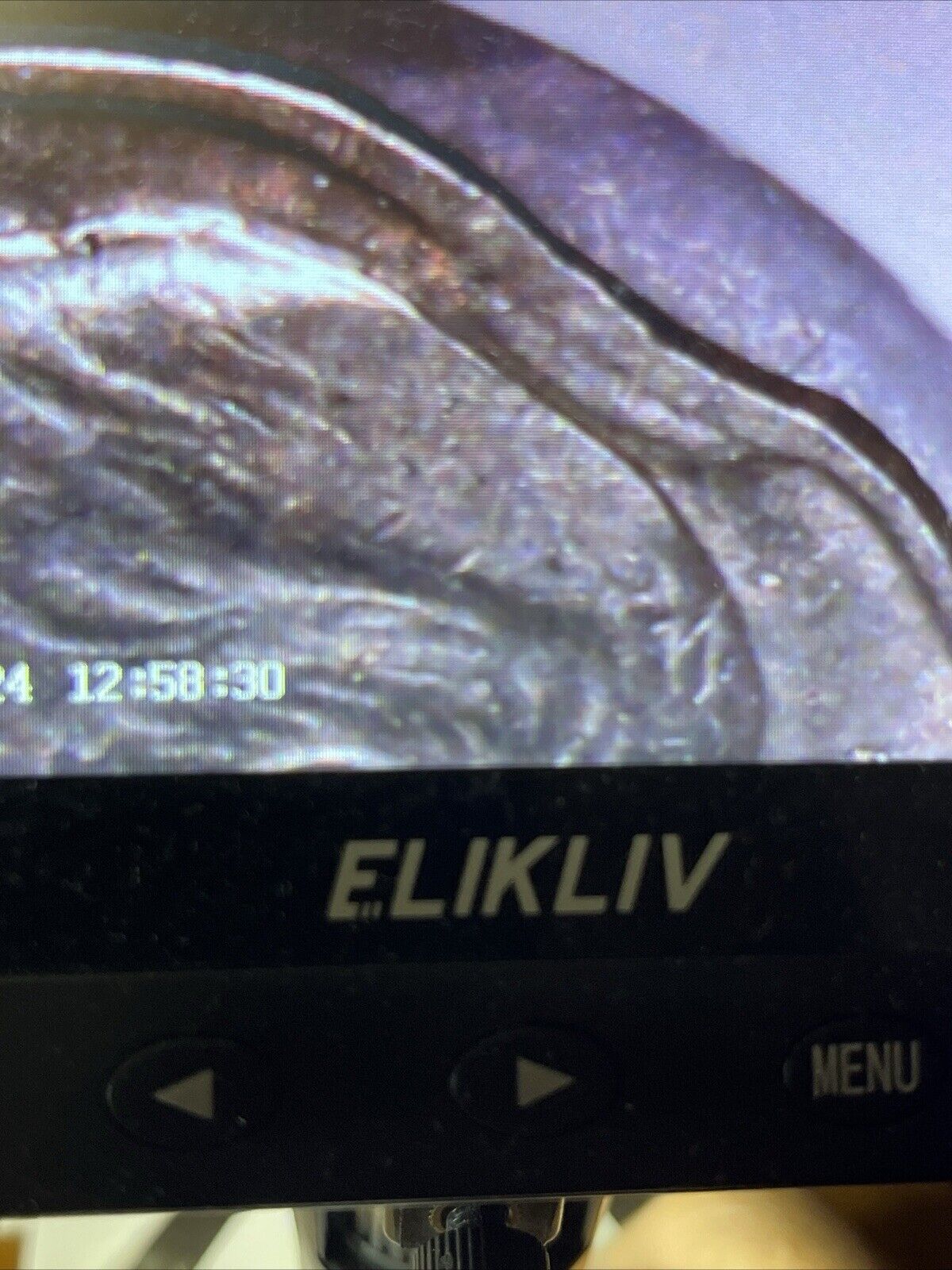 Picture 18 of 20
