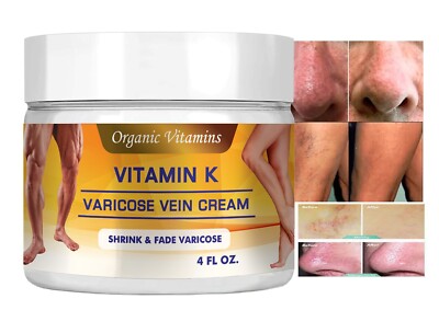 Vitamin K Cream Spider Varicose Veins Scars Rosacea Capillaries