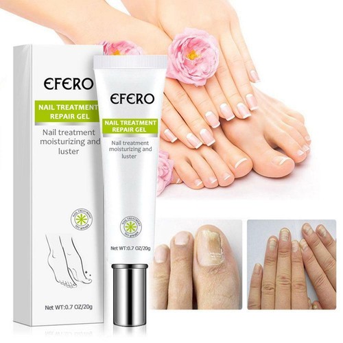 EFERO Nail Repair Essence Remove Onychomycosis Serum Fungal Nail Treatment 20g - Bild 3 von 10
