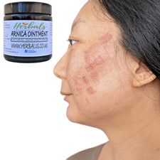 Arnica Cream for Bruises & Scars – Handmade Herbal Ointment