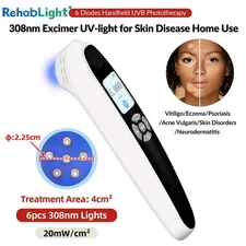 308nm Excimer Ultraviolet Light Therapy for White Marks on Skin Disease 20mW/cm2