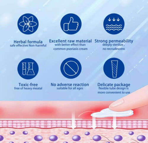 Psoriasis Dermatitis Ekzem natürliche Creme Hautbehandlung Salbe KOSTENLOSER VERSAND - Bild 11 von 14