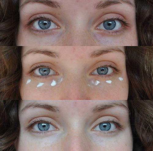 3-LURONICS ANTI-DARK CIRCLE EYE CREAM 15 ml (e2b)