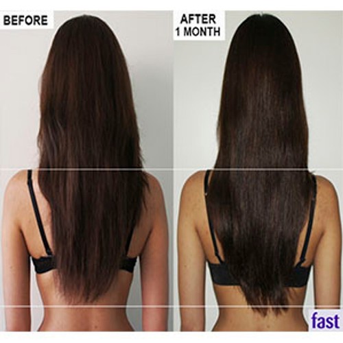 DAILY MAIL Recommended FAST Hair Growth Shampoo and Conditioner Vitamin B - Picture 9 of 17
