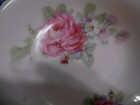 Foto 3 di 11
