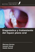 DiagnóStico Y Tratamiento Del Liquen Plano Oral Maroua Garma (U. A.) Taschenbuch