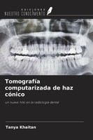 Tanya Khaitan | TomografíA Computarizada De Haz CóNico | Taschenbuch | Spanisch