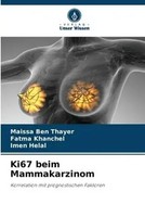 Maissa Ben Thayer (U. A.) | Ki67 Beim Mammakarzinom | Taschenbuch | Deutsch