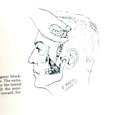 Vintage Facial Pain Book Second Edition Hardcover Lea & Febiger 1977