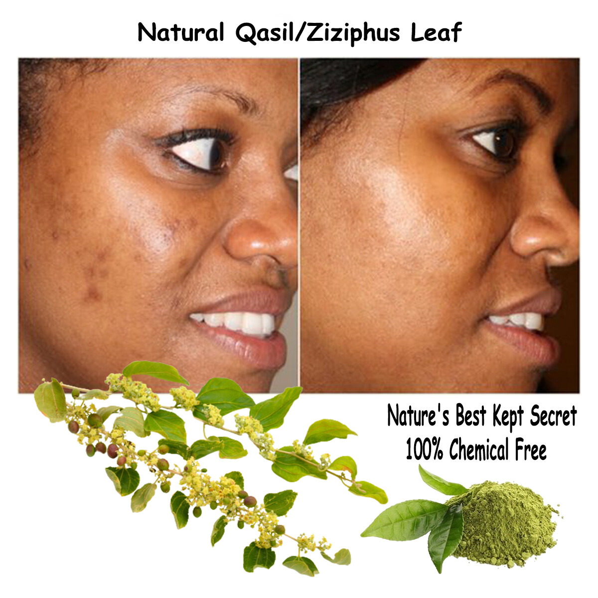 Ruqyah Qasil Powder Jar Sidr Cedar Ziziphus Natural Skin Hair Mask Acne