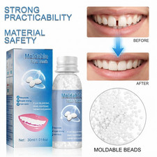 Temporary Tooth Repair Beads for Missing Broken Teeth, Dental Tooth Filling