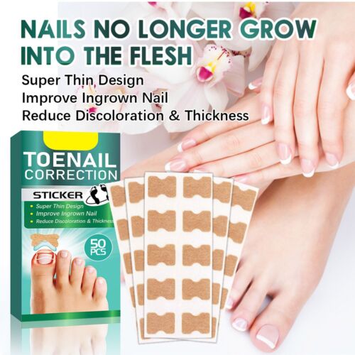 50pcs Ingrown Toenail Correction Stickers Hands Feet Soft Nail Inlaid Care Patch - Picture 8 of 8