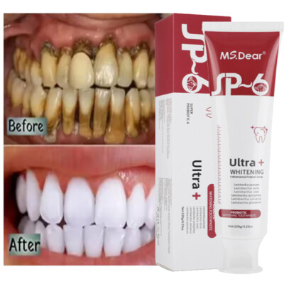 SP-6 Probiotic Whitening Toothpaste Quick Brightening Removes Bad Breath Fresh