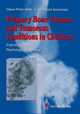 Primary Bone Tumors and Tumorous Conditions i...