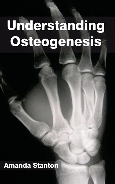 Amanda Stanton | Understanding Osteogenesis | Buch | Englisch (2015) | Gebunden-image