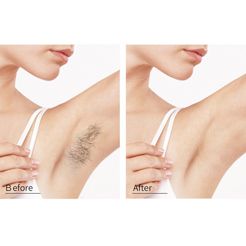 150ML Detvfo Depilation Spray Hair Removal Depilation Spray Depilya