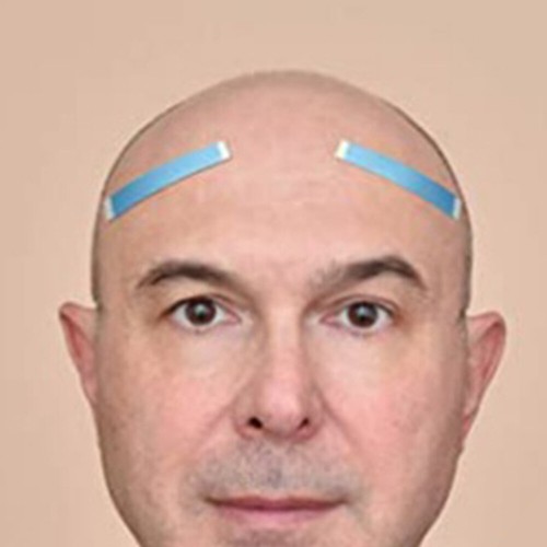 12 Stück Haarverlängerungsfolie Klebeband für Perücken Klebeverlängerungen - Bild 8 von 11