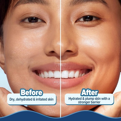 Aqualogica Barrier+ Hydra Gel Moisturizer with 5 Ceramides & Avocado 200g - Picture 8 of 10