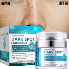 Crema Blanqueadora Para Mujer Y Hombre Elimina Manchas Y Acne De La Cara Crema