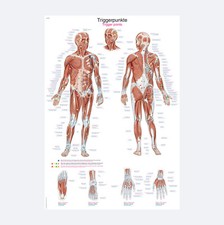 Lehrtafel Triggerpunkte | Poster 70 x 100 cm ...