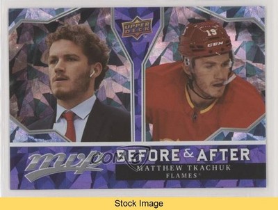 2021-22 Upper Deck MVP Before and After Matthew Tkachuk #BA-16 READ 0s9c