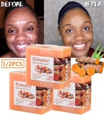 2×Tumeric Soap Ginger Anti-Acne Dark Spots Scars Removal Body Whitening Soap Bar