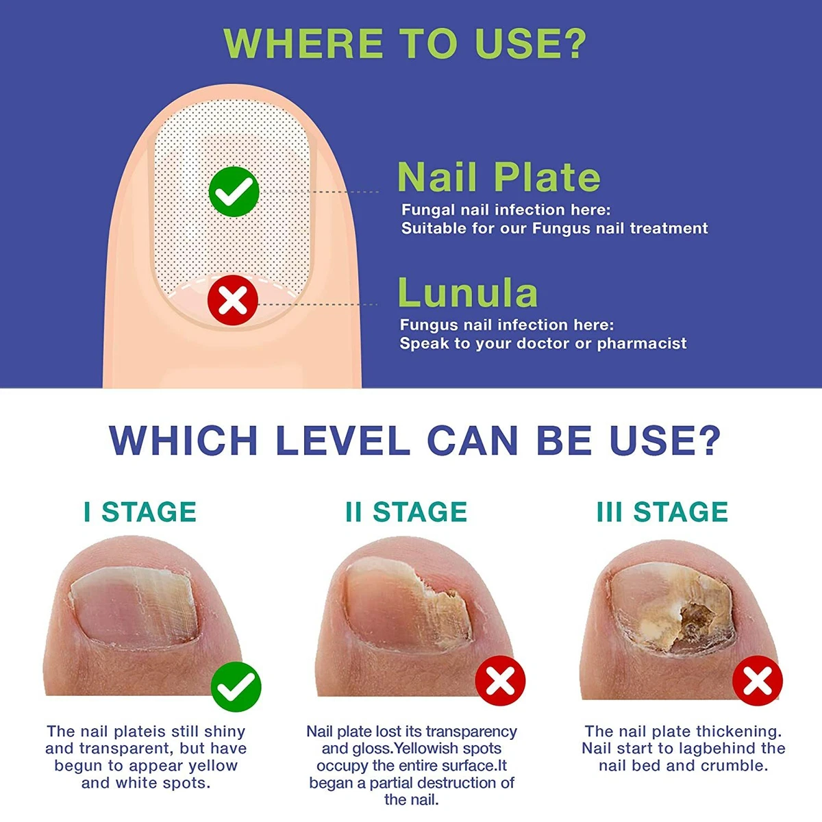 LANBENA Nail Fungus Treatment Essence Serum Hand in Central Division - Bath  & Body, Bwetinde Business Enterprises | Jiji.ug