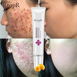 best cream for acne scars and pores