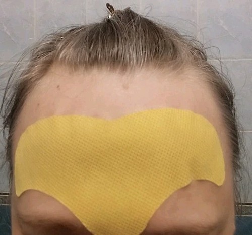 10 Pcs Forehead Anti Wrinkle Patches with Collagen for Face Overnight - Picture 10 of 11