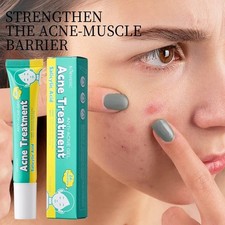 2PCS Salicylic Acid Acne Treatment Face Cream Repair Pimple Spots Cleaning Pore