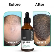 Hair Growth Serum  with Redensyl, Anagain, Procapil  Capilia Longa 30ml