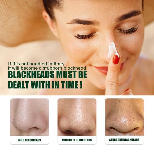 60x LANBENA Pore Strips Blackhead Remover Cream Nose Acne OFF Clean best E1O4 - Picture 7 of 10