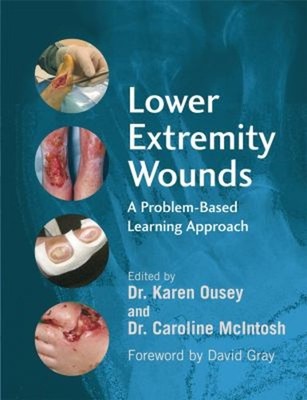 Lower Extremity Wounds : A Problem-Based Approach Paperback