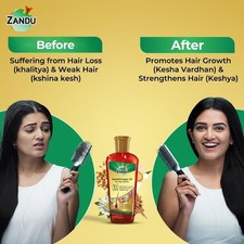 100 Ayurvedic Hair Growth Oil Neelibhringar Taila Pak Vidhi Reduce Hair Fall