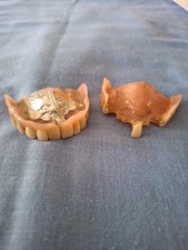 2 DENTIERS HAUT