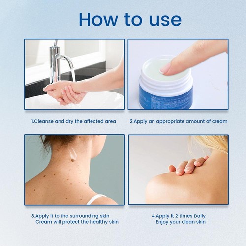 2xWart Removal Body Warts Treatment Cream Foot Care Crea m Skin Tag Remover - Picture 7 of 10