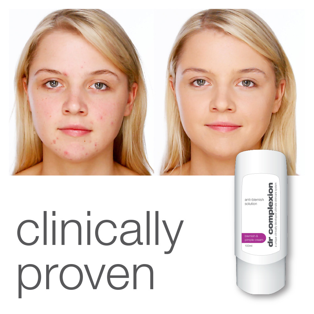 DR COMPLEXION ANTI BLEMISH SOLUTION BLEMISH & PIMPLE CREAM STOPS RED SCARING