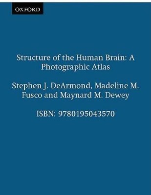Structure of the Human Brain: A Photographic Atlas - Spiral-bound - ACCEPTABLE