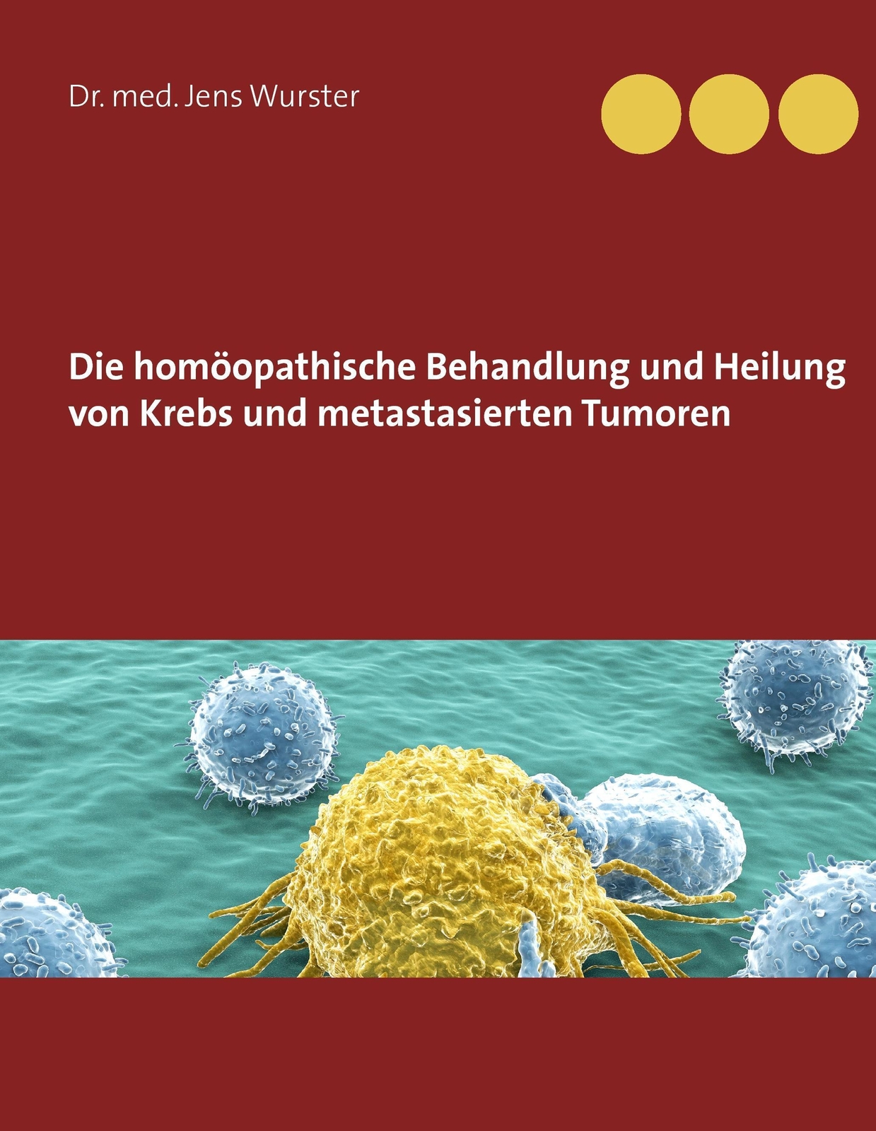 Thumbnail - Die Homöopathische Behandlung Und Heilung Von Krebs Und Metastasierten