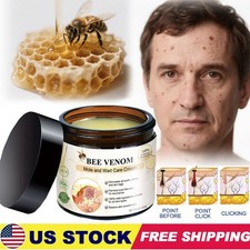 Bee Venom Skin Tag Removal Treatment Cream Body Care Mole Corn Wart Remover