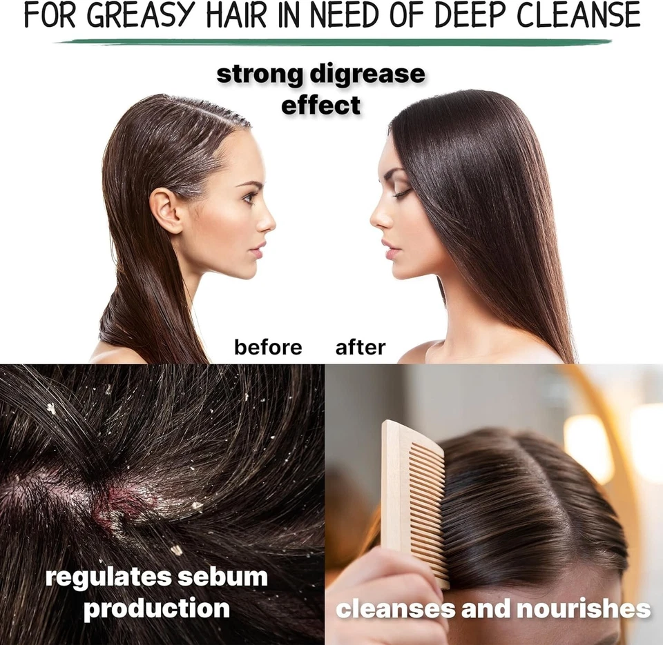 Natürlicher Brennnessel Extrakt Haarshampoo mit bulgarischen Kräutern von Milva - 200 ml - Bild 4 von 4