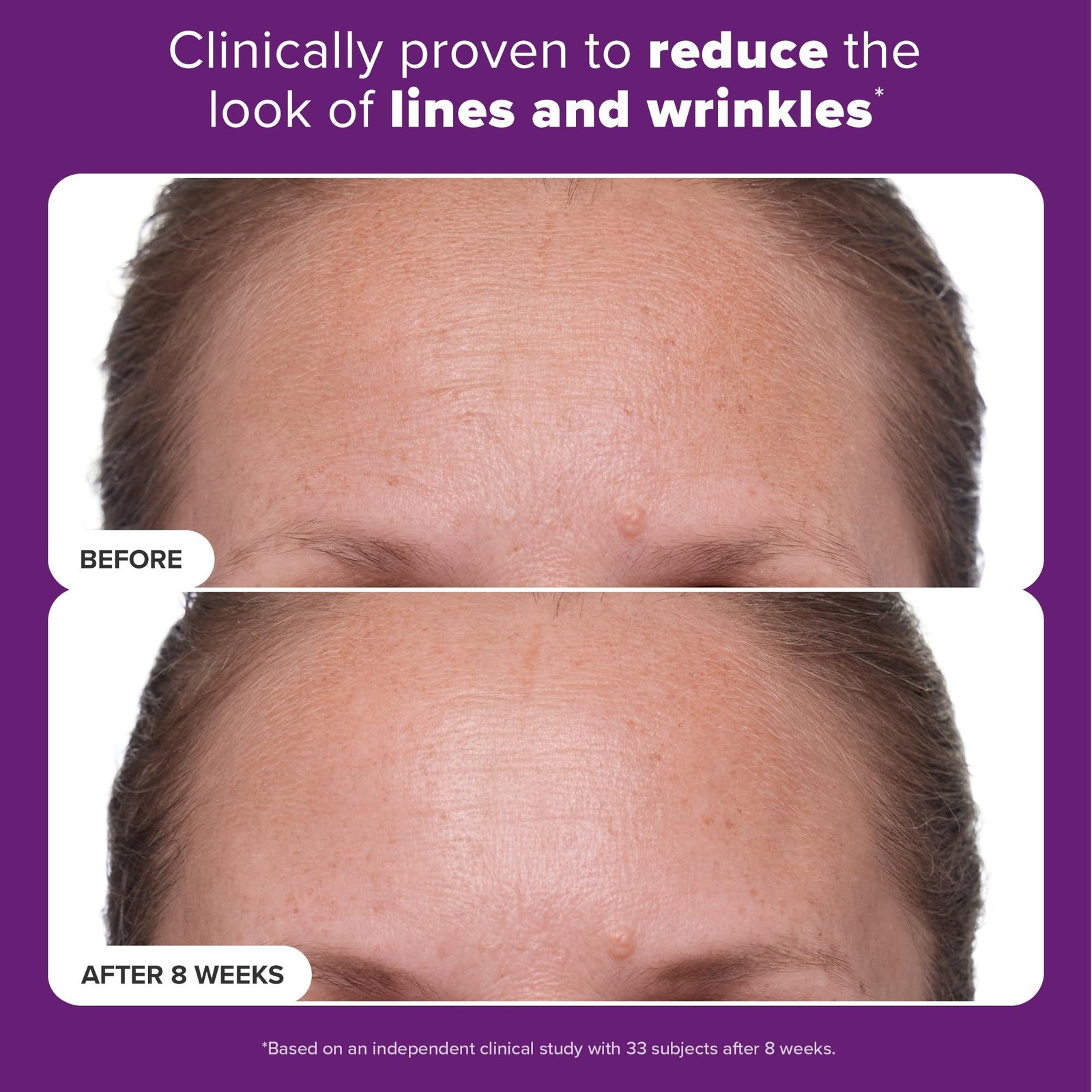 Paula's Choice CLINICAL 1% Retinol Face Moisturizer Treatment with Peptides, ...