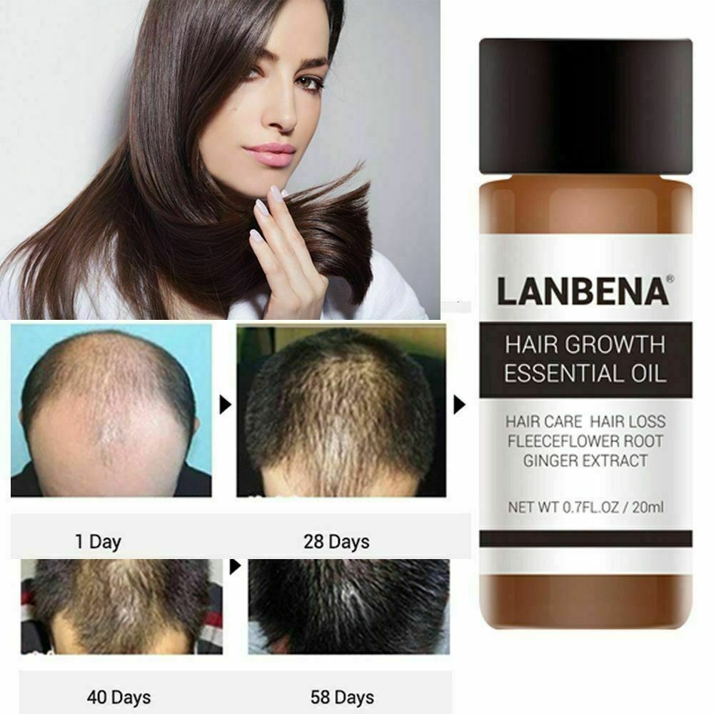 20ml