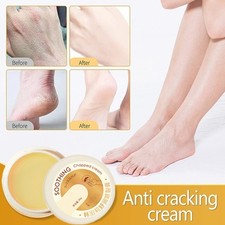 20g Cracked Skin Repair Cream Winter Crack Hand Foot Cream Anti-Cracking Frost
