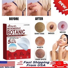 Microneedle Botanic Skin Tag  Acne Patch Skin Tag Remover Patches 9Pcs HOT