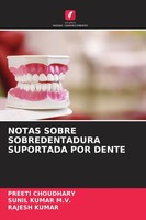 Notas Sobre Sobredentadura Suportada POR Dente Rajesh Kumar