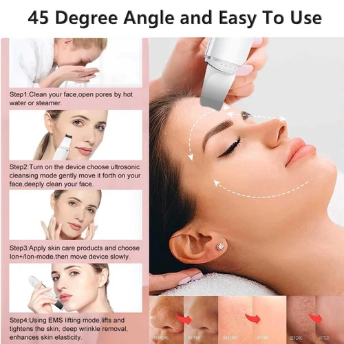 Exfoliante de piel facial raspador y removedor de puntos negros espátula facial exfoliante de piel - Imagen 3 de 6