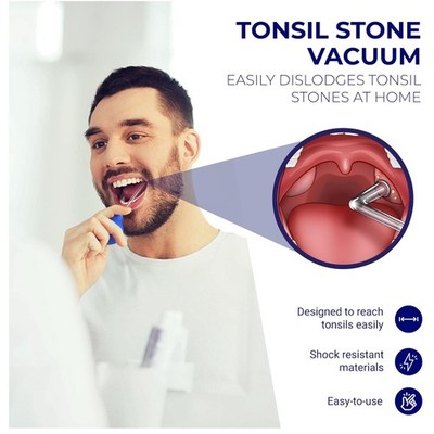 Tonsil Stone Vacuum Remover - Gag Reflex Reducer