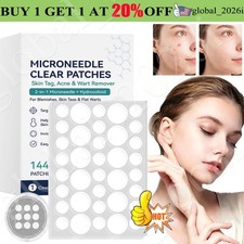 Curalona Microneedle Patches 144pcs, Skin Tag Wart Acne Remover Patches 20 OFF